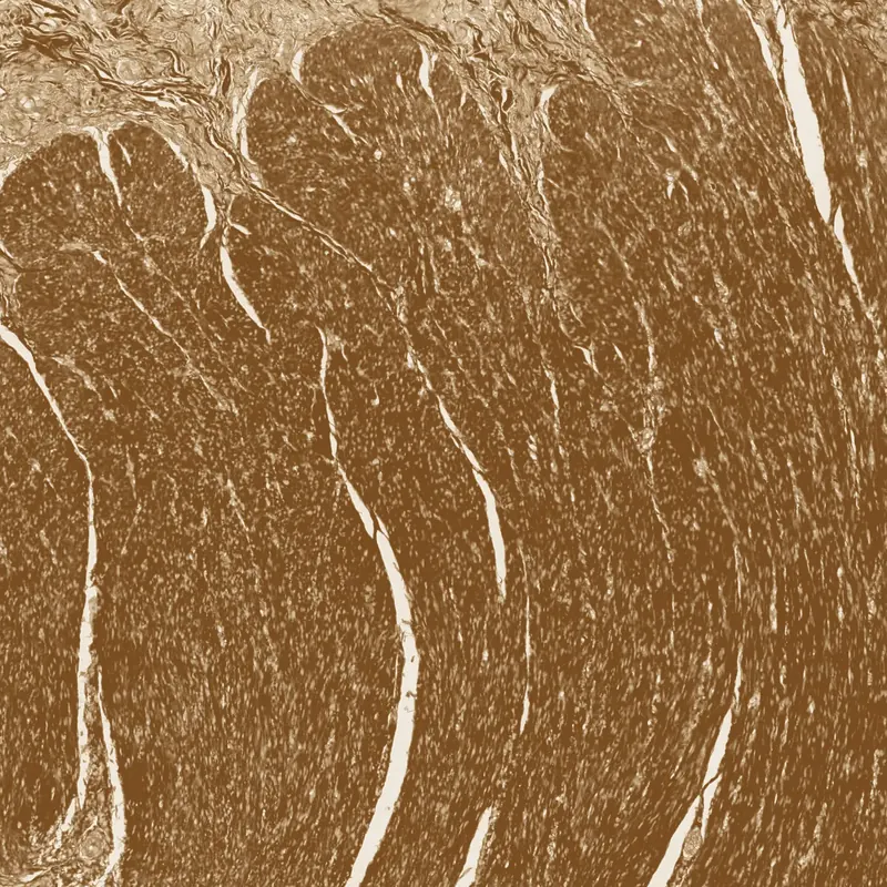 IHC 棕染肌层